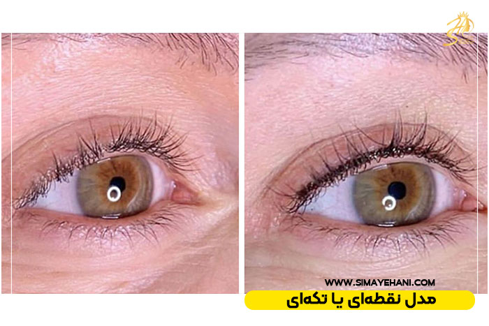 بن مژه مدل نقطه‌ای یا تکه‌ای