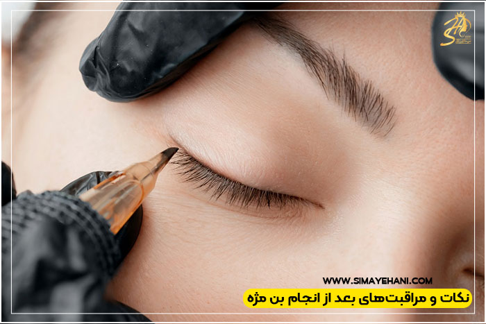 ماندگاری بن مژه