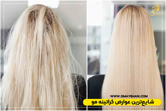 عوارض کراتینه کردن 