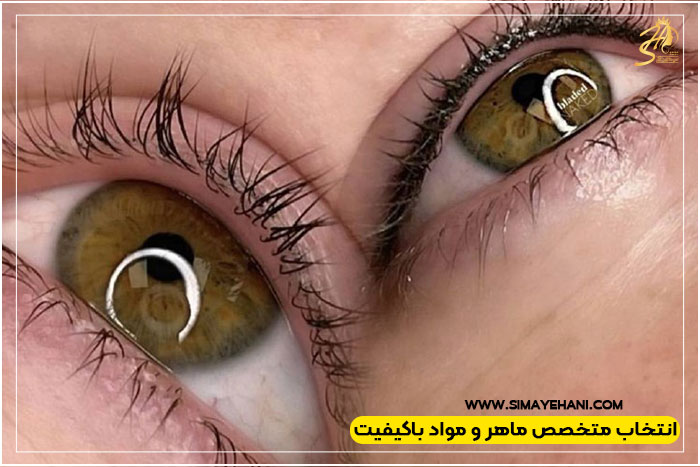عوارض بن مژه 