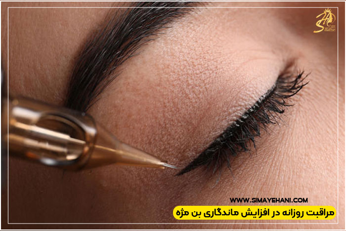  بن مژه