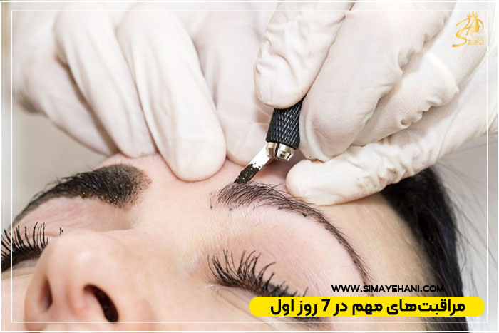 مراقبت‌های بعد از انجام میکروبلیدینگ 