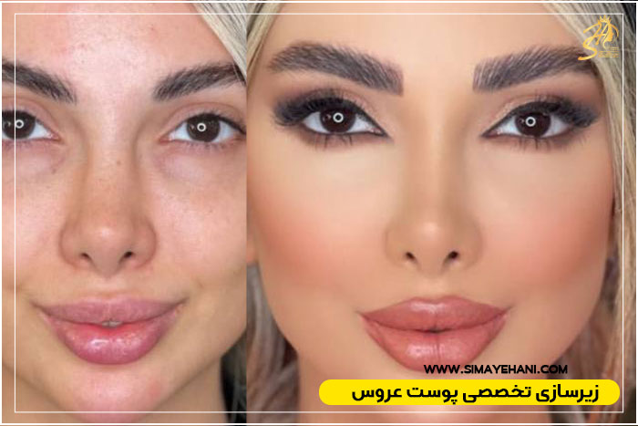زیرسازی تخصصی پوست
