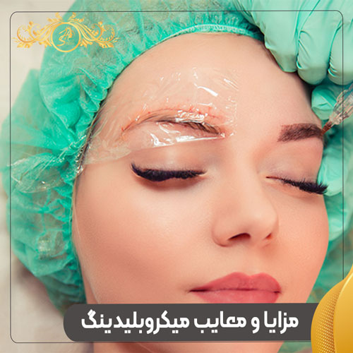 مزایا و معایب میکروبلیدینگ