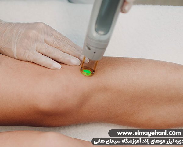 laser hair removal 5