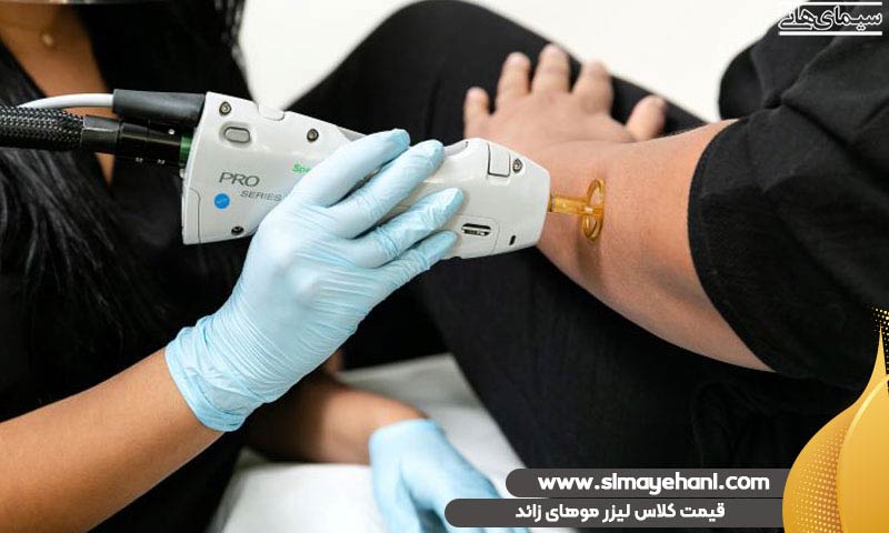 قیمت کلاس لیزر موهای زائد