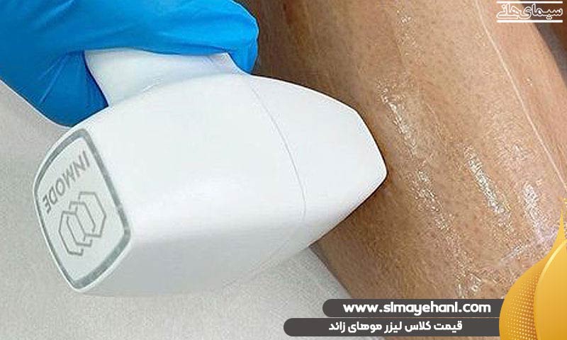 قیمت کلاس لیزر موهای زائد