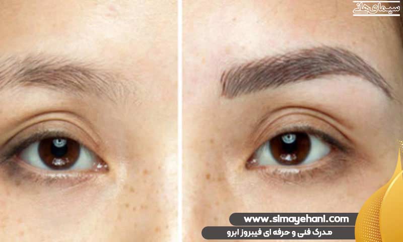 مدرک فنی و حرفه ای فیبروز ابرو