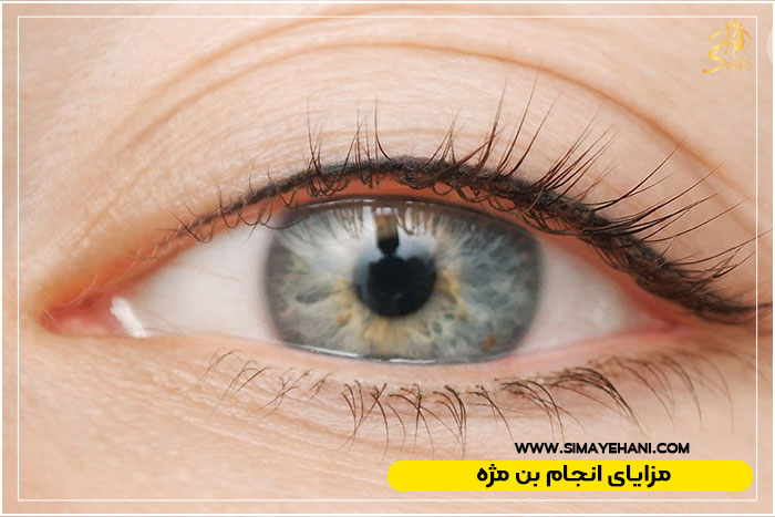 بن مژه چشم
