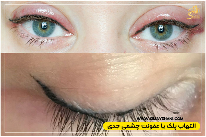 بهداشت محیط و ابزار
