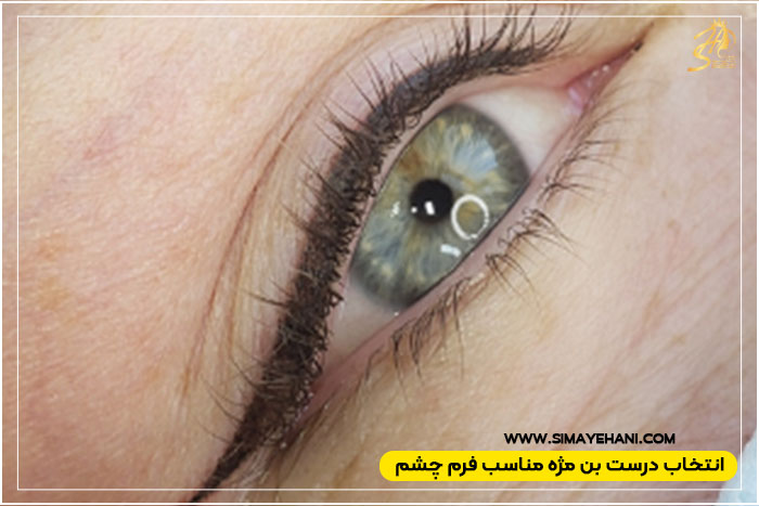 شناخت فرم چشم 