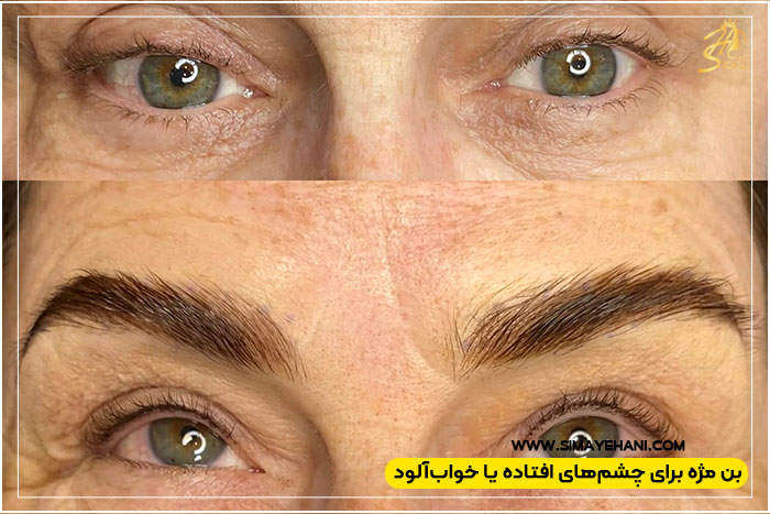  چشم‌های افتاده یا خواب‌آلود