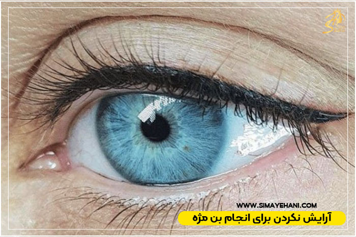  انجام بن مژه