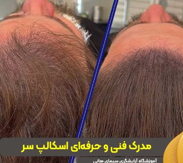 مدرک فنی و حرفهای اسکالپ سر