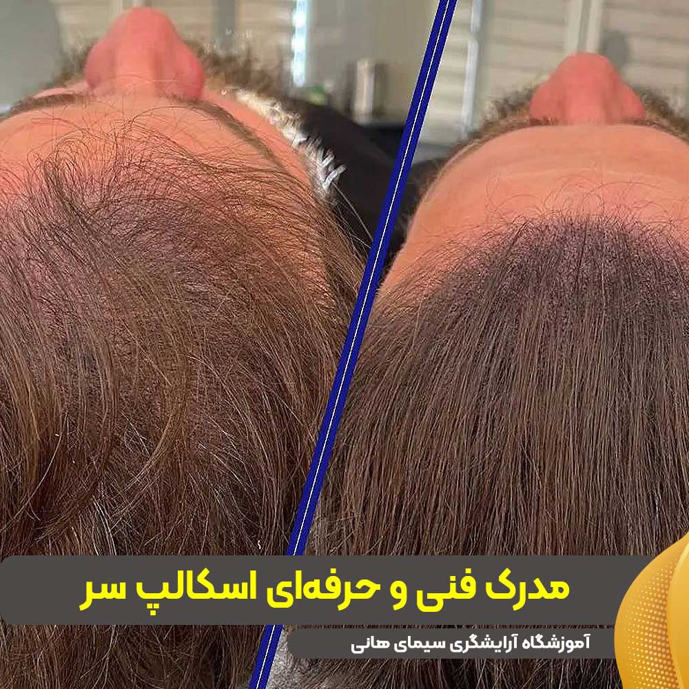 مدرک فنی و حرفهای اسکالپ سر