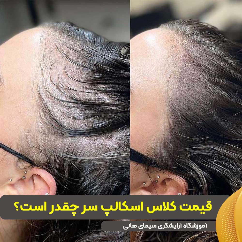 قیمت کلاس اسکالپ سر
