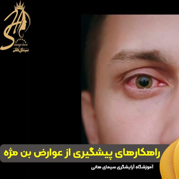 پیشگیری از عوارض بن مژه