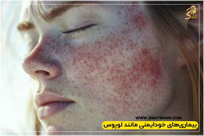 موارد منع فیبروز ابرو
