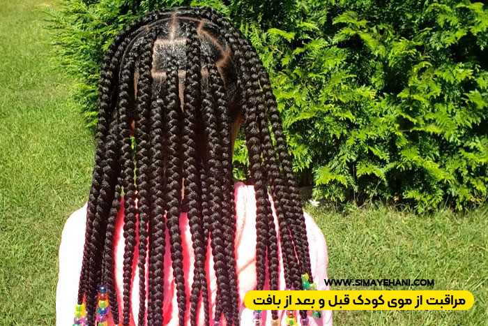 بافت مو کودکانه