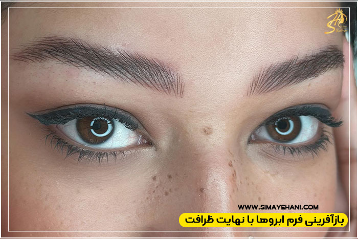 تفاوت فیبروز ابرو با میکروبلیدینگ