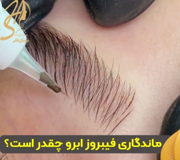 ماندگاری فیبروز ابرو
