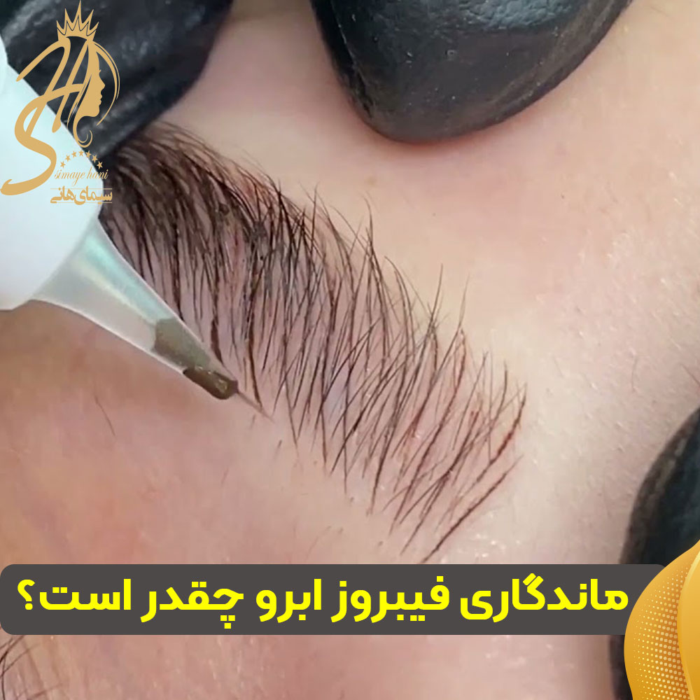 ماندگاری فیبروز ابرو