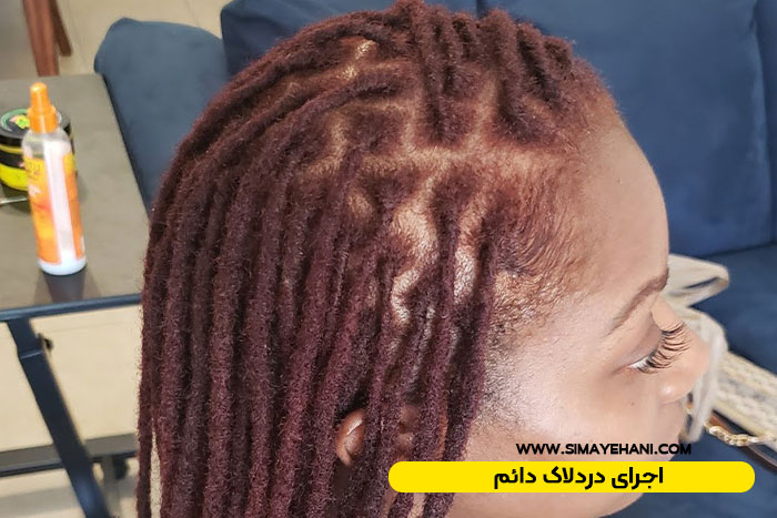 اجرای دردلاک دائم