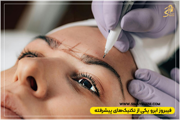 تفاوت فیبروز ابرو با میکروبلیدینگ