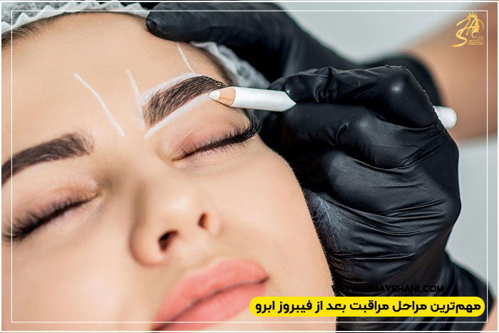 مراقبت های بعد از فیبروز ابرو