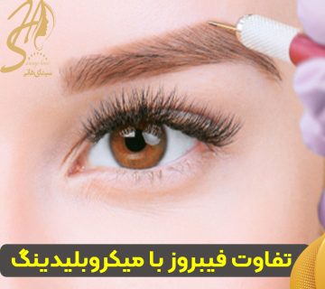 فیبروز ابرو چیست