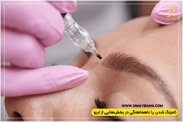 تفاوت اجرای ترمیم