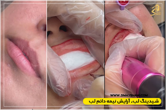 مراحل انجام شیدینگ لب