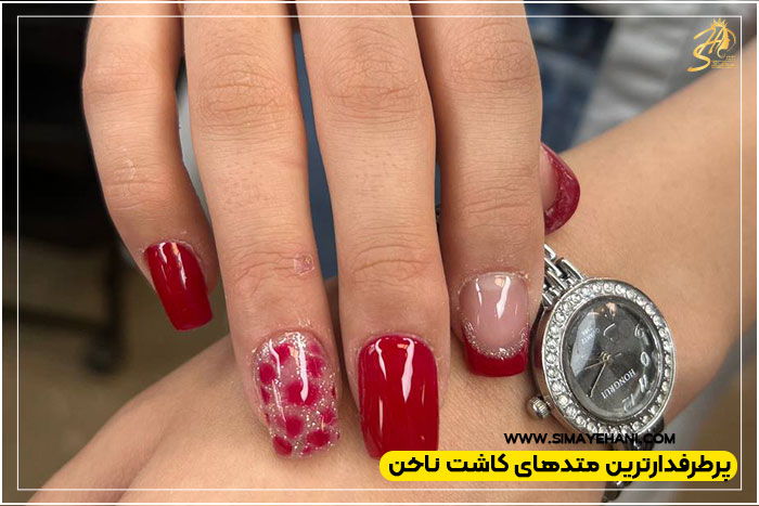 روش کاشت ناخن