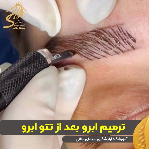 ترمیم ابرو بعد از میکرو و فیبروز