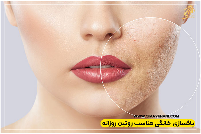 پاکسازی خانگی یا کلینیکی