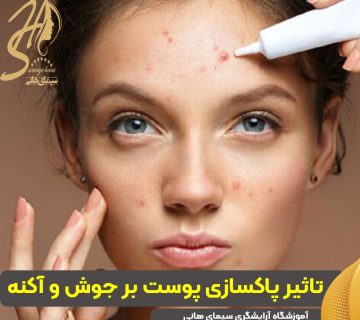 تاثیر پاکسازی پوست بر جوش و آکنه