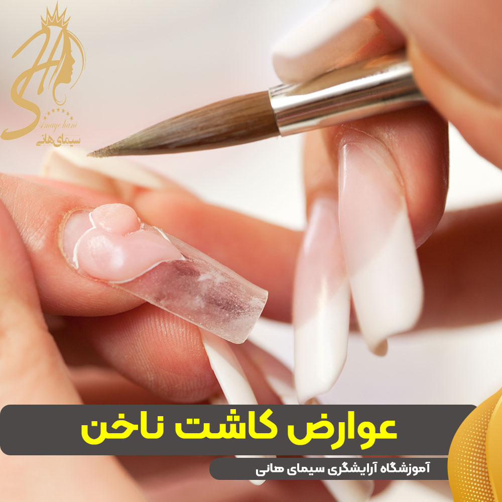 عوارض کاشت ناخن