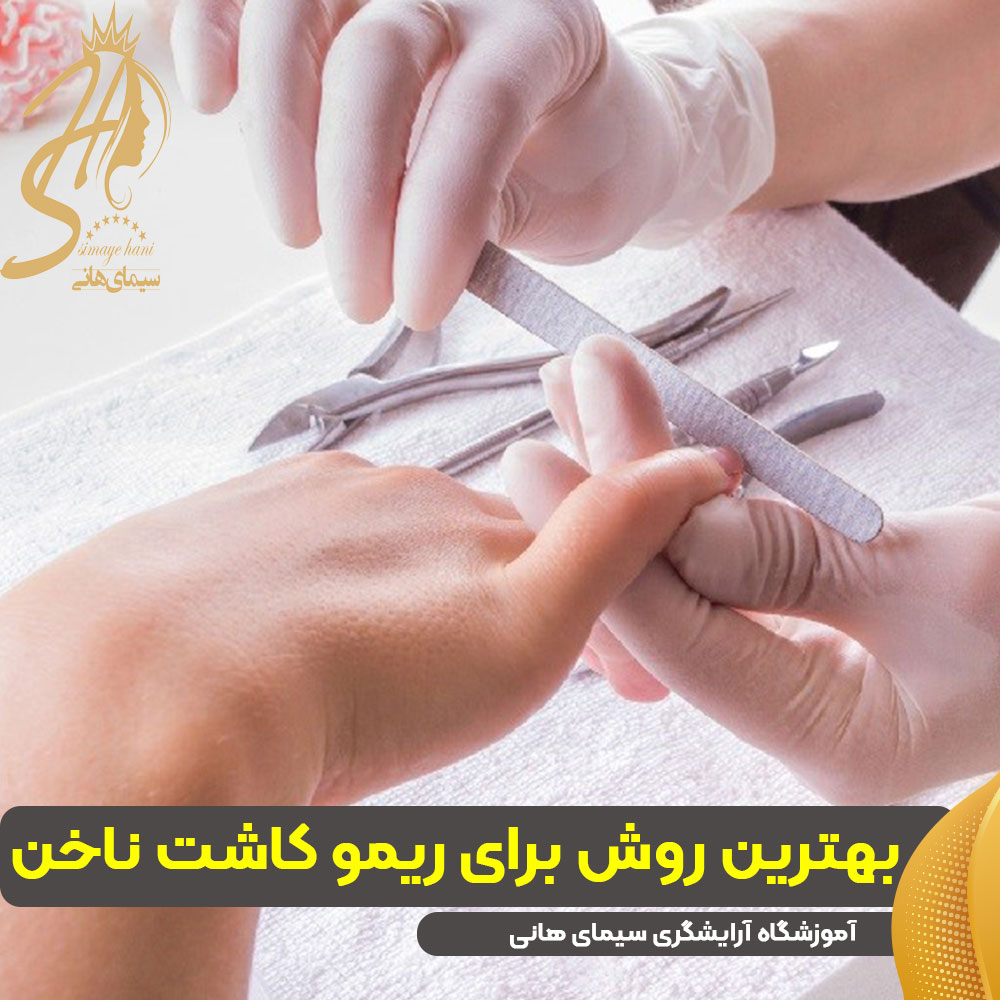 بهترین روش برای ریمو یا برداشتن کاشت ناخن