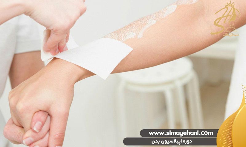 دوره آموزش اپیلاسیون بدن