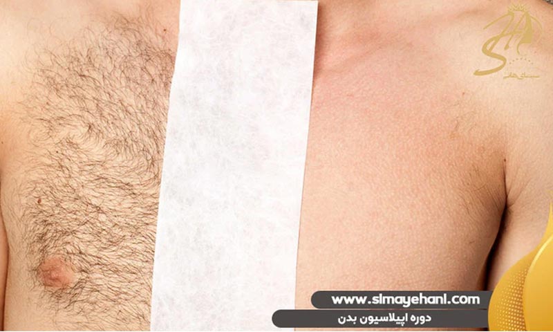 دوره اپیلاسیون بدن فنی حرفه ای