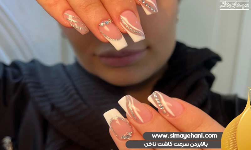 بالا بردن سرعت کاشت ناخن