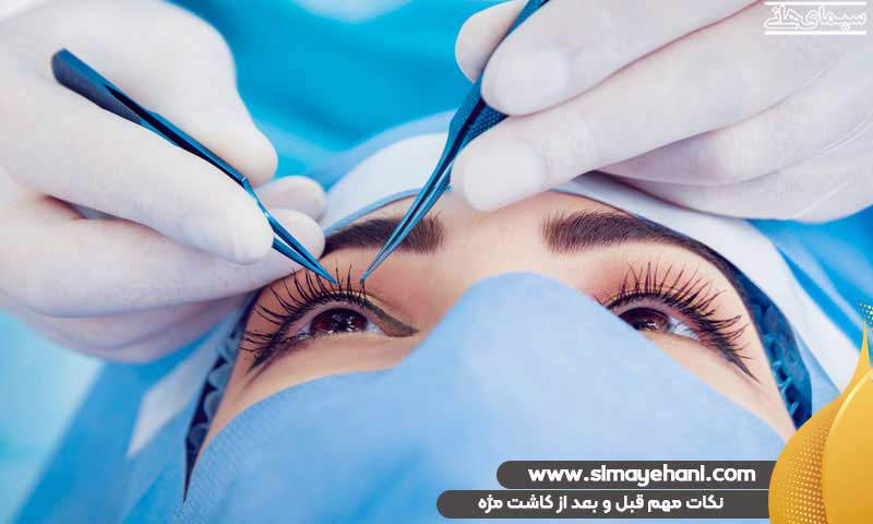 نکات مهم قبل از کاشت مژه