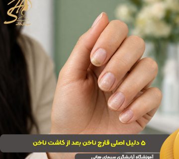 دلیل قارچ ناخن بعد از کاشت ناخن