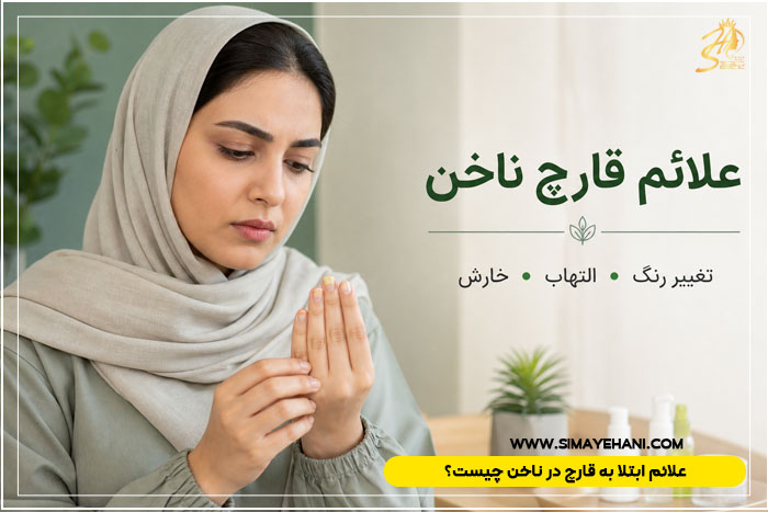 دلیل ایجاد قارچ در ناخن بعد از کاشت ناخن