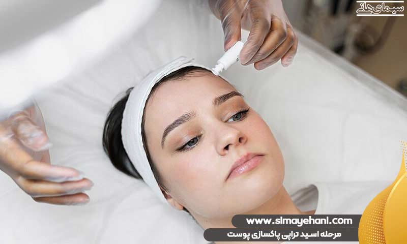مرحله اسید تراپی پاکسازی پوست