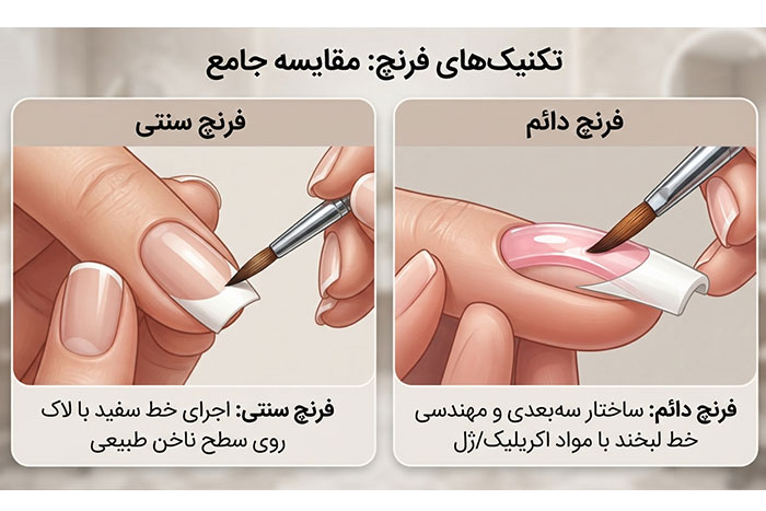 تفاوت کاشت فرنچ دائم با کاشت معمولی چیست