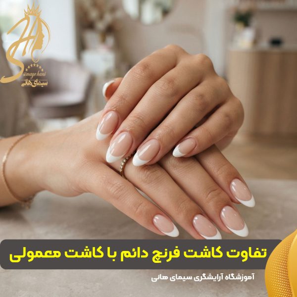تفاوت کاشت فرنچ دائم با کاشت معمولی