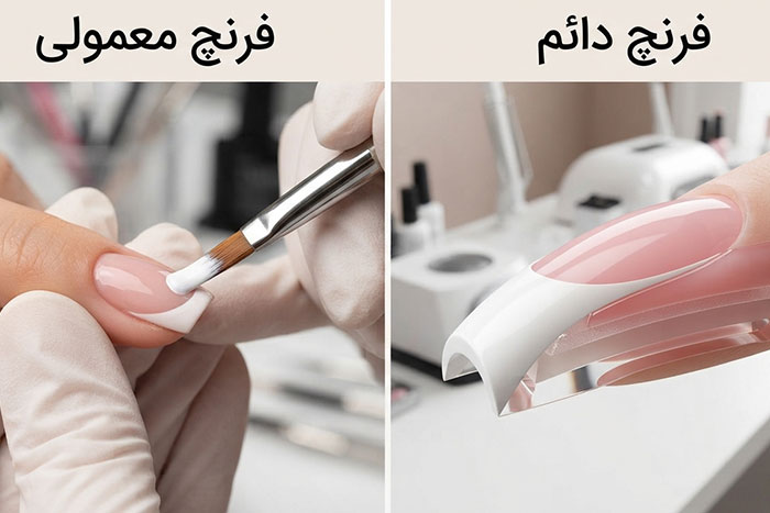 تفاوت فرنچ دائم با فرنچ موقت