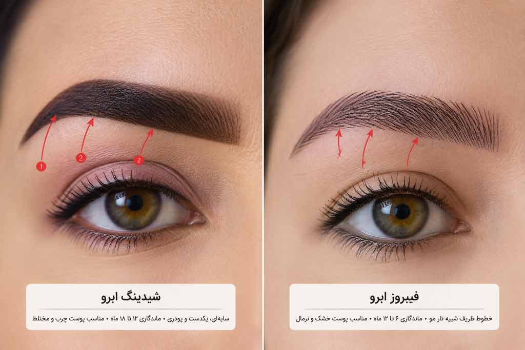 شیدینگ بهتره یا فیبروز