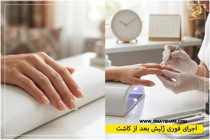 بهترین زمان ژلیش